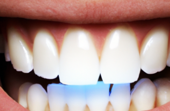 Are LED Teeth Whitening Kits Safe for Your Teeth?