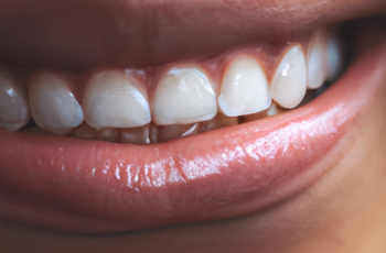 Everything you need to know about LED teeth whitening